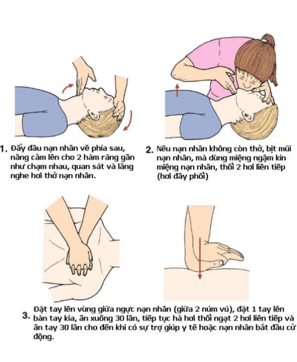 so-cuu-nguoi-dien-giat